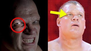 What Happened to Kane’s Eye?  5 Things WWE NEVER Explained About Kane!