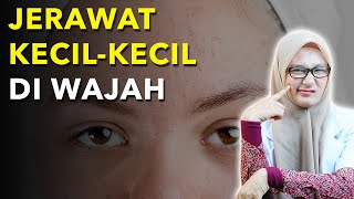 Pencet Jerawat Bikin Ngilu...!!! #jerawat #skincare