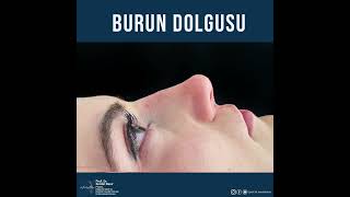 Ameli̇yatsiz Burun Esteti̇ği̇ Burun Dolgusu