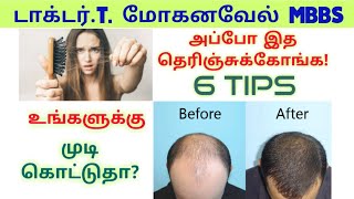 STOP HAIR FALL- முடி கொட்டாமல் இருக்க-HAIR GROWTH-TAMIL
DR MOHANAVEL