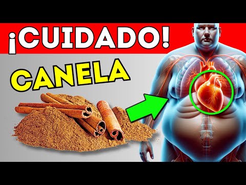 ESTO SUCEDE si