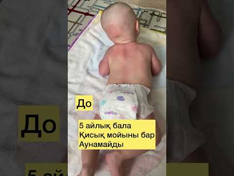 Бейне: Torticollis түзетудің қарапайым әдістері: 15 қадам (суреттермен)