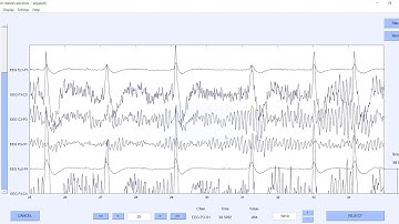 46 Basics of BCI Experimentation: Signal Acquisition using MATLAB (EEGLAB)
