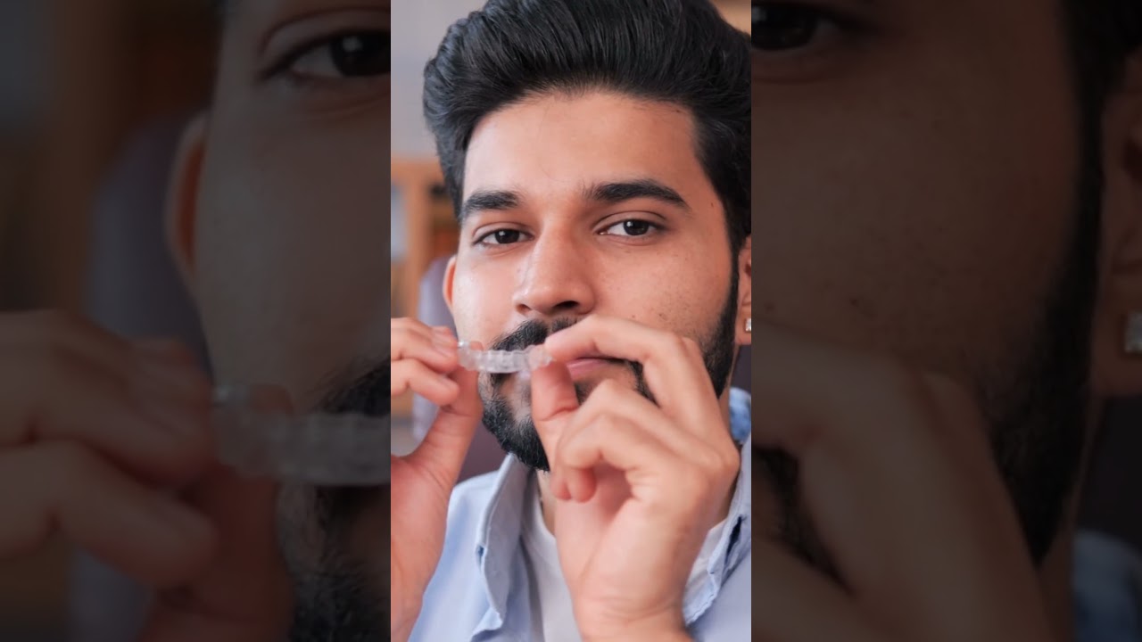 Invisalign Offer: Get ₹50,000 OFF + Free Consultation at Radiant Dental Care