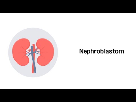 Nierentumor (Nephroblastom) - Erkrankungen der Niere