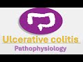 Ulcerative Colitis Pathophysiology Ulcerative Colitis Pathophysiology
