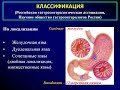 2 курс ФКП. Лекция на тему: "Язвенная болезнь".