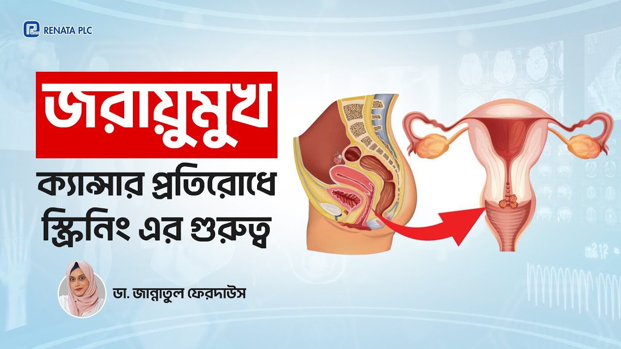 জরায়ুমুখ ক্যান্সার প্রতিরোধে Screening | Cervical Cancer Prevention & Early Detection