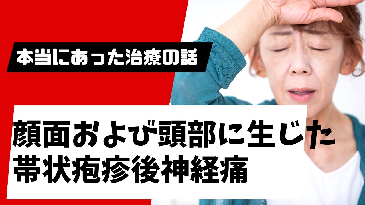 帯状 疱疹 の 後遺症