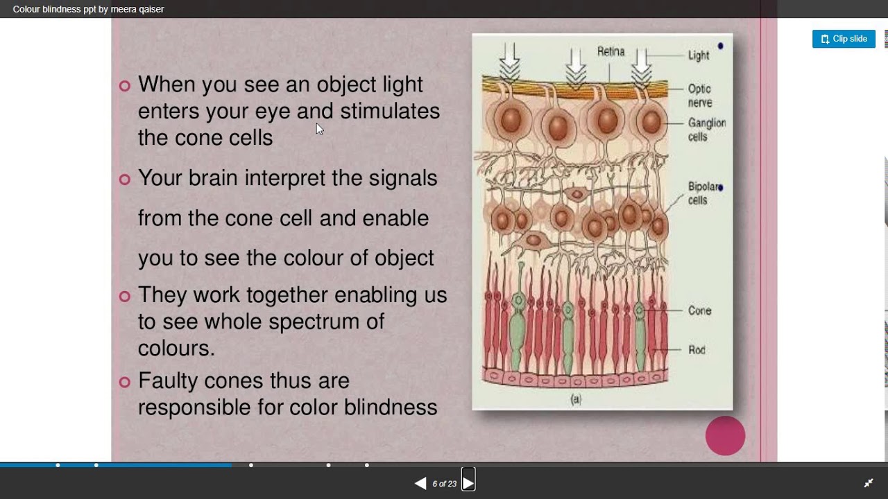 Chapter5 Class 12 biology Mendelian disorder Colourblindness by