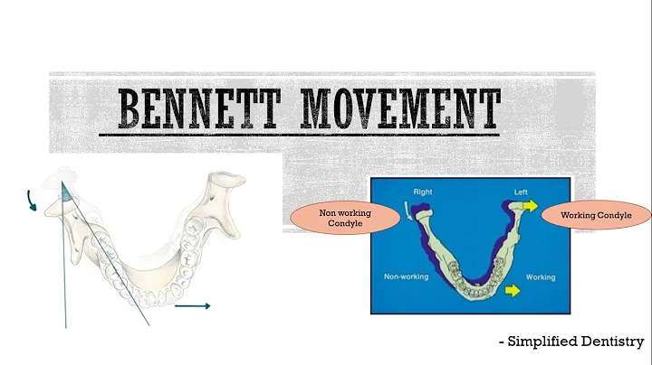 Bennett movement