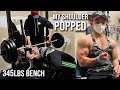 Shoulder Popped During Bench Press