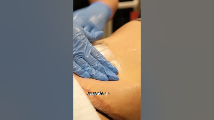 ¿Sabes cómo se hace la cura tras una abdominoplastia? ¡Mira el vídeo! #liposuction #abdominoplastia