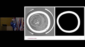 Johann Briffa - Automated Segmentation of Microtomography Imaging Using Machine Learning