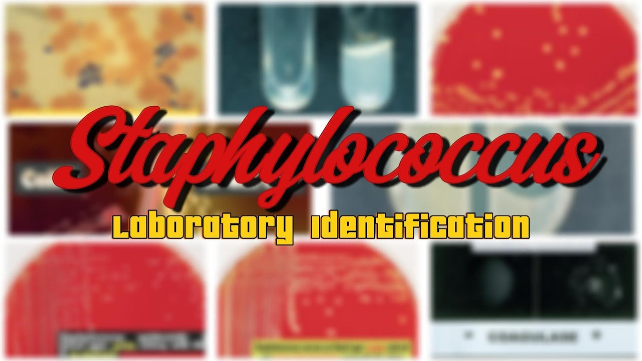 التعريف المعملي للـ Staphylococcus خطوة بخطوة | تشخيص علمي بطريقة سهلة