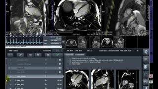 MRI Cardiac..... CMR screenshot 5