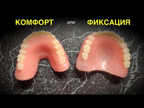 Что выбрать: БЕЗ нёба или с Нёбом?! #безнёбасъёмныепротезы #съёмныезубныепротезы