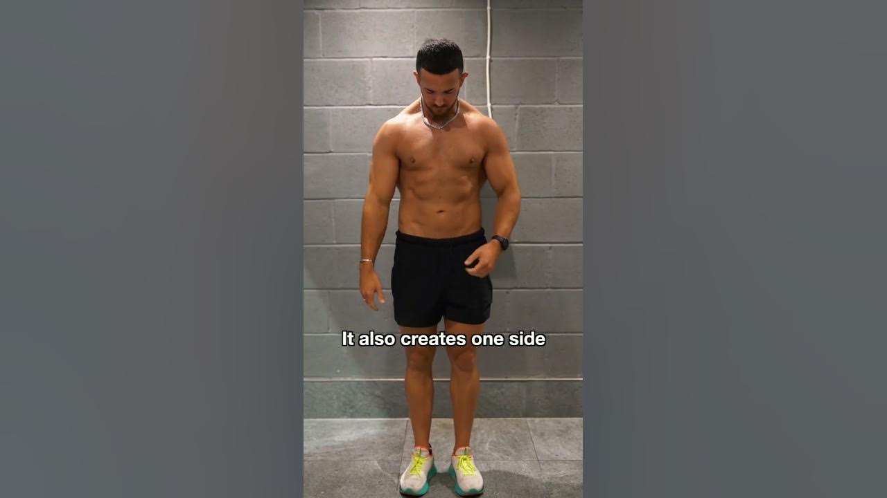 How to fix Pigeon Chest (UNEVEN PECS) YouTube