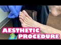 ANTI-AGING BRAZILIAN FOOT LIFT