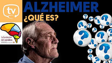 ¿Qué fase del Alzheimer es la más larga?