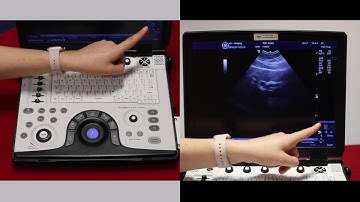 How to use basic B mode settings on the GE logiq e ultrasound scanner - video 2