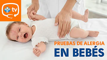 ¿Cómo se hacen las pruebas para detectar alergias en los bebés?