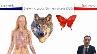Download lagu Systemic Lupus Erythematosus Systemic Lupus Erythematosus