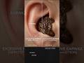 The Science of Earwax Removal | How Your Ears Clean Themselves Naturally | #medical #shots #earwax