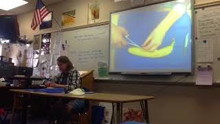 Download lagu Demonstration on giving sutures by Katelyn H Demonstration on giving sutures by Katelyn H