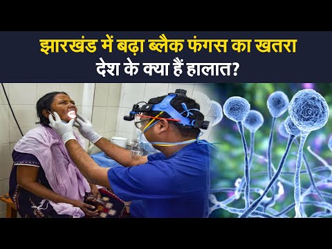 Jharkhand में बढ़ रहे Black Fungus के मरीज, देशभर में क्या है स्थिति  | Prabhat Khabar