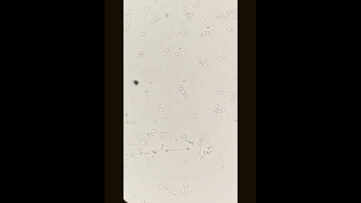 Fungal hyphae under the microscope #laboratory #microscope #mls #cls #fungi #yeastcells #spores