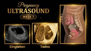 Sonogram : Week 7 | Singleton (Single Baby) vs Twins