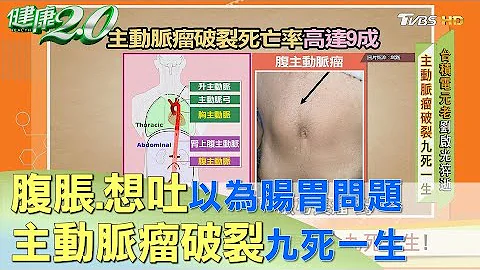 主動脈瘤不是腫瘤 卻更要命九死一生！ 健康2.0 - 天天要聞
