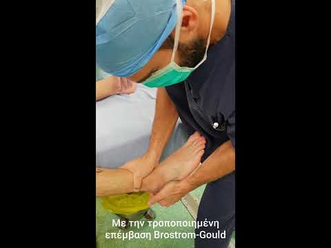 Βίντεο: Πώς να αντιμετωπίσετε ένα διάστρεμμα στο γόνατο: 13 βήματα (με εικόνες)