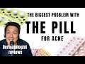 ACNE TREATMENTS | Hormonal Control & The Pill