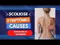 Scoliose  symptmes causes volution et traitement