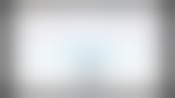 Giant MCA Aneurysm Clipping and TSA-M2 Double-Barrel Bypass