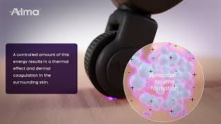 Pixel Rf Animation Video