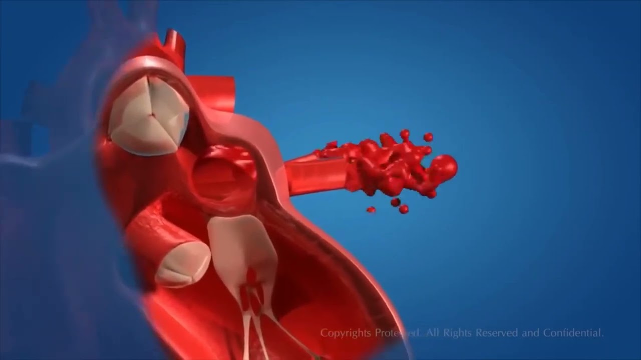 Ανθρώπινο Κυκλοφορικό Σύστημα (μετάφραση)