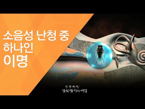 소음성 난청 중 하나인 이명 - (2011.10.1_387회 방송)_볼륨을 줄여라, 소음성 난청