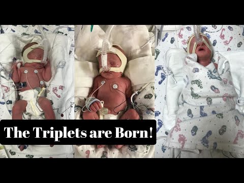 Triplets Preterm Labor, Delivery, and NICU Stay | Triplet Pregnancy and Birth | Episode 2