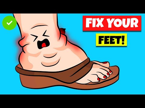    Herstel uw gezwollen voeten snel met deze huismiddeltjes voor gezwollen voeten