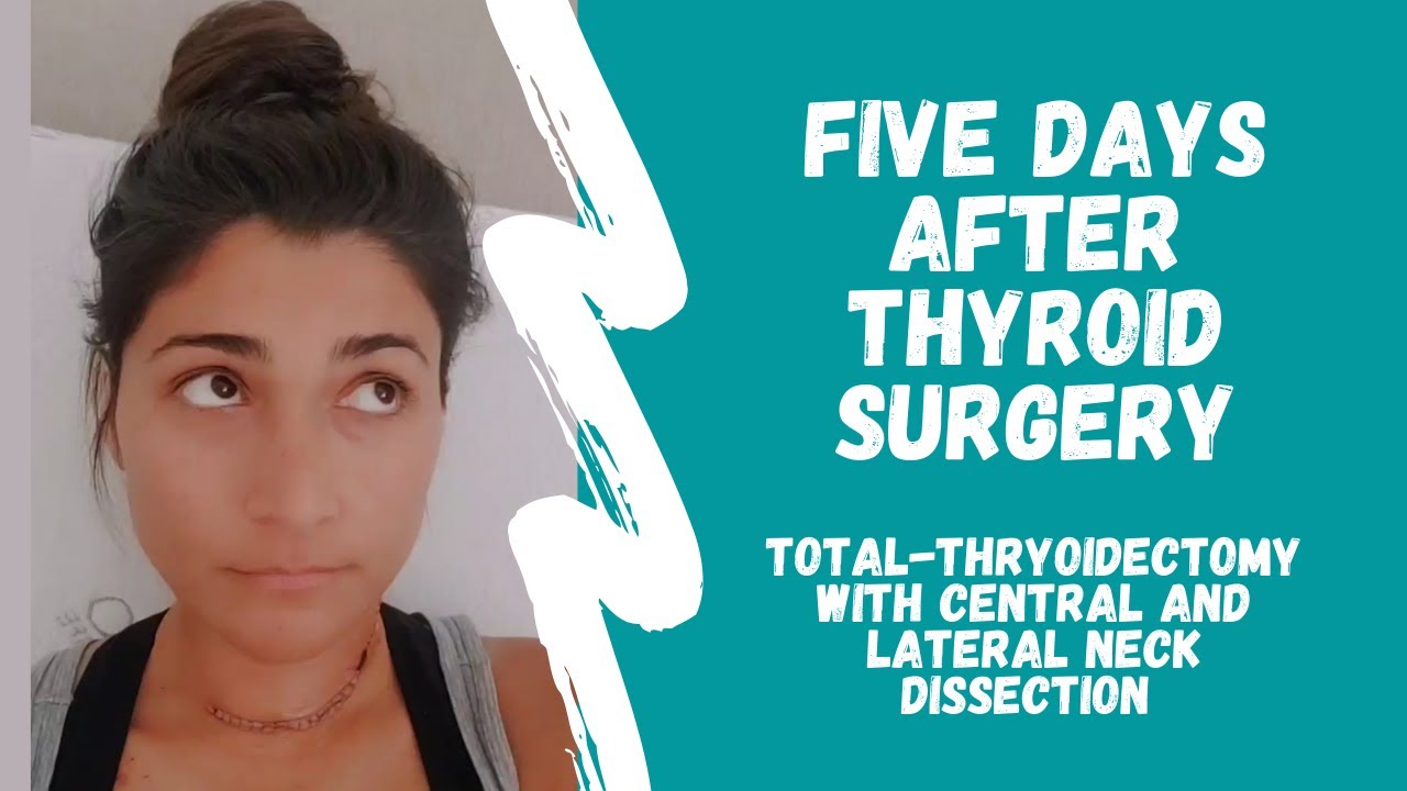 Thyroid Cancer, Thyroid Surgery, and Neck Dissection 5 Days After