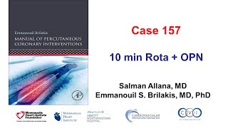 Case 157: Manual of PCI: 10 min Rota + OPN