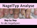 Nagelmodellage / Nagel Typ Analyse /