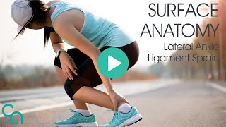 Surface Anatomy of a Sprained Ankle