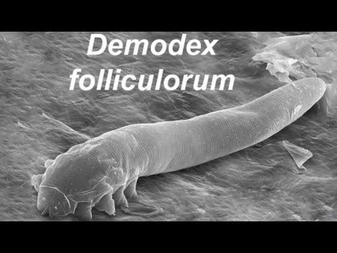 Demodex Folliculorum Железница Угревая - Морфология, Жизненный цикл, Профилактика, Диагностика