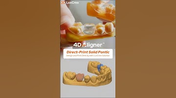 Direct-Print Solid Pontics with LuxCreo