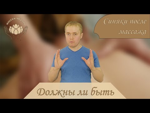 Синяки после массажа, нормально ли