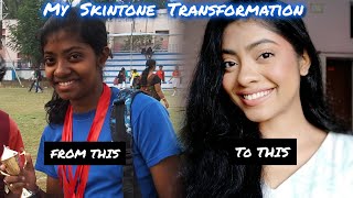 My Skintone Transformation things that actually worked
